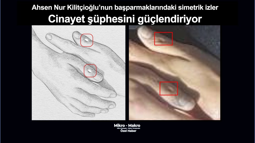 https://mikro-makro.net/ahsen-nur-kilitcioglunun-iki-basparmagindaki-simetrik-izler-cinayet-suphesini-guclendiriyor