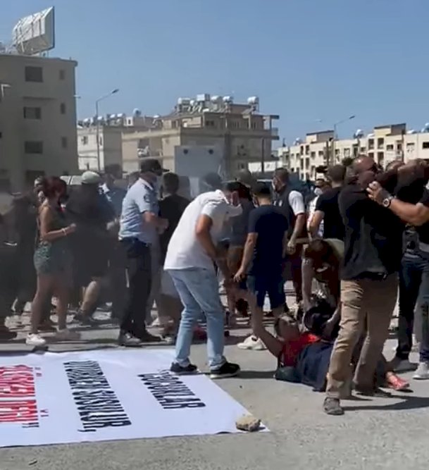 Asya bebek için yapılan gösteride polisin müdahalesine Kıbrıs Türk Barolar Birliği’nden tepki