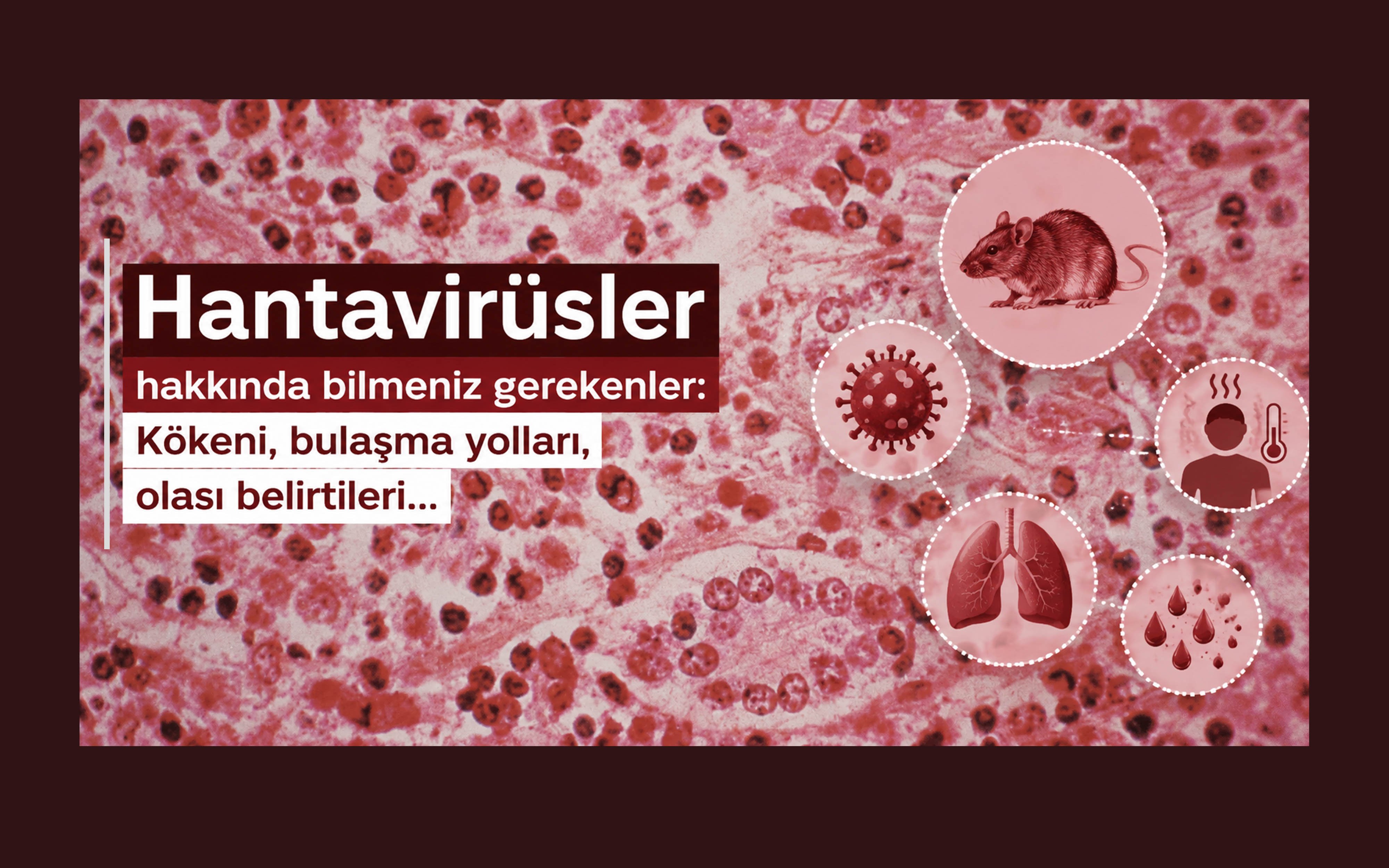 DSÖ: 3 ölüm de dahil 8 vaka bildirildi. 5 vaka hantavirüs olarak doğrulandı, diğer 3'ü ise şüpheli